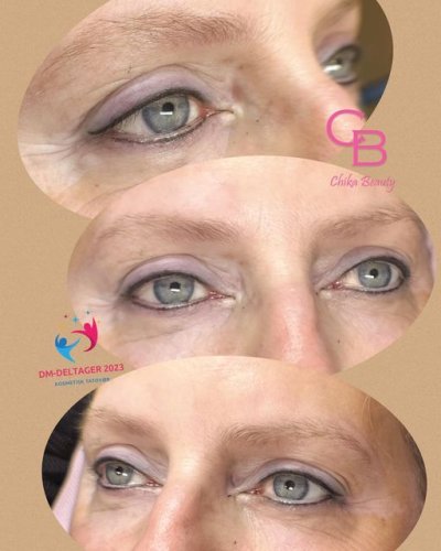Permanent makeup før og efter hos Chika Beauty – billede 5