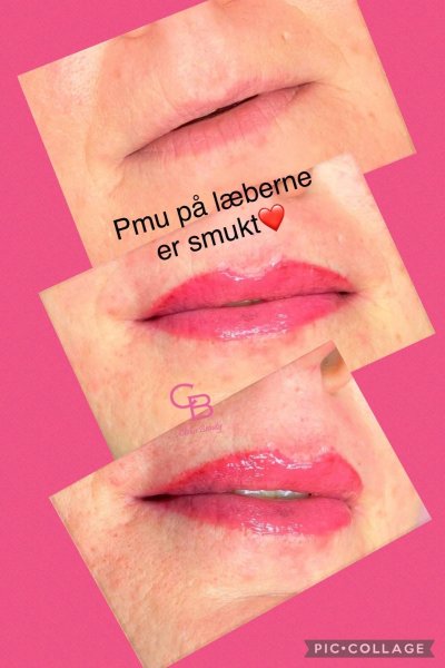 Resultater
