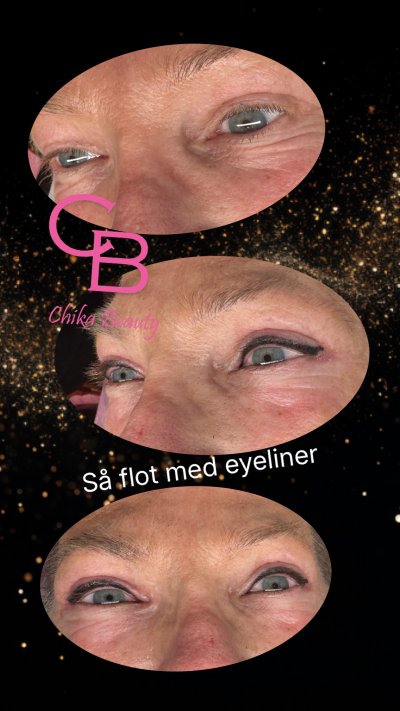 Resultater