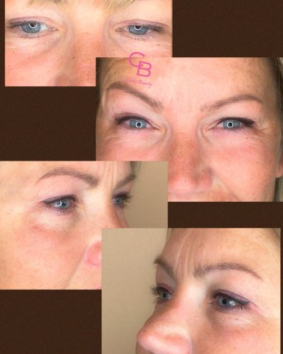 Permanent makeup før og efter hos Chika Beauty – billede 31