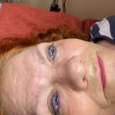 Lash lift og brow lift hos Chika Beauty – billede 5